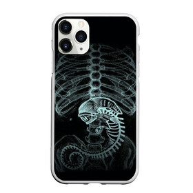 Чехол для iPhone 11 Pro Max матовый с принтом Чужой на Рентгене в Кировске, Силикон |  | alien | больница | больной | внутренний мир | врач | клиника | кости | пациент | ребра | рентген | скелет | снимок | хищник