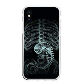 Чехол для iPhone XS Max матовый с принтом Чужой на Рентгене в Кировске, Силикон | Область печати: задняя сторона чехла, без боковых панелей | alien | больница | больной | внутренний мир | врач | клиника | кости | пациент | ребра | рентген | скелет | снимок | хищник