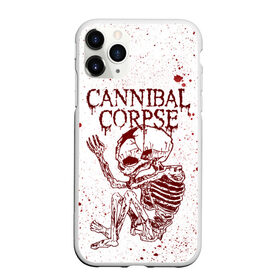 Чехол для iPhone 11 Pro матовый с принтом Cannibal Corpse в Кировске, Силикон |  | canibal corpse | cannibal corpse | death metal | группы | дэт метал | канибал корпс | метал | рок